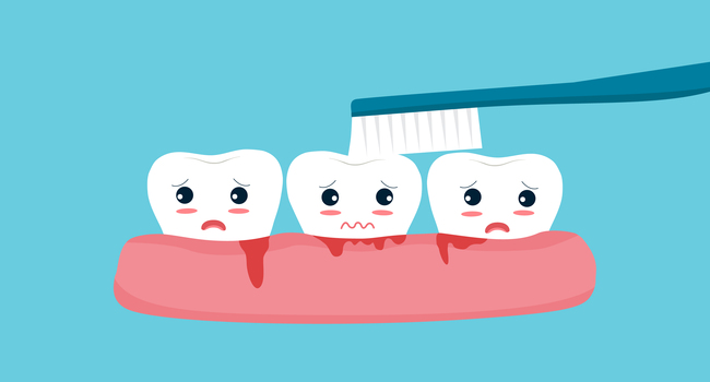 Assessing the cause of bleeding gums at a dental examination