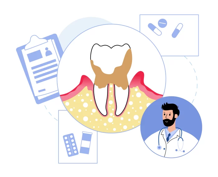 oral care that helps gum inflammation: a soft brush and dental floss