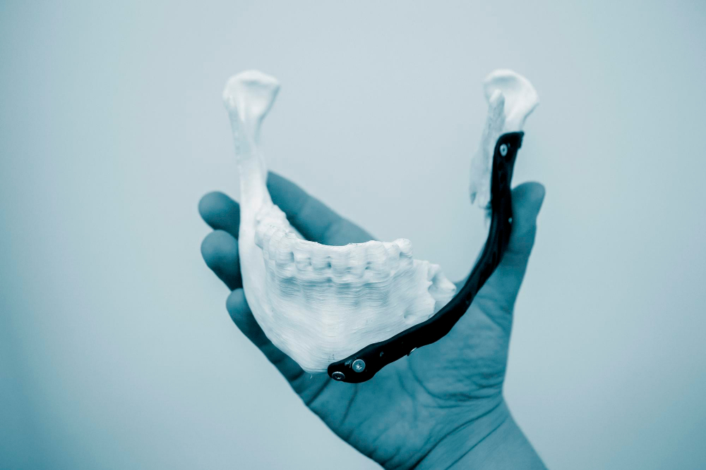 Orthognathic surgery: repositioning the upper and lower jaw