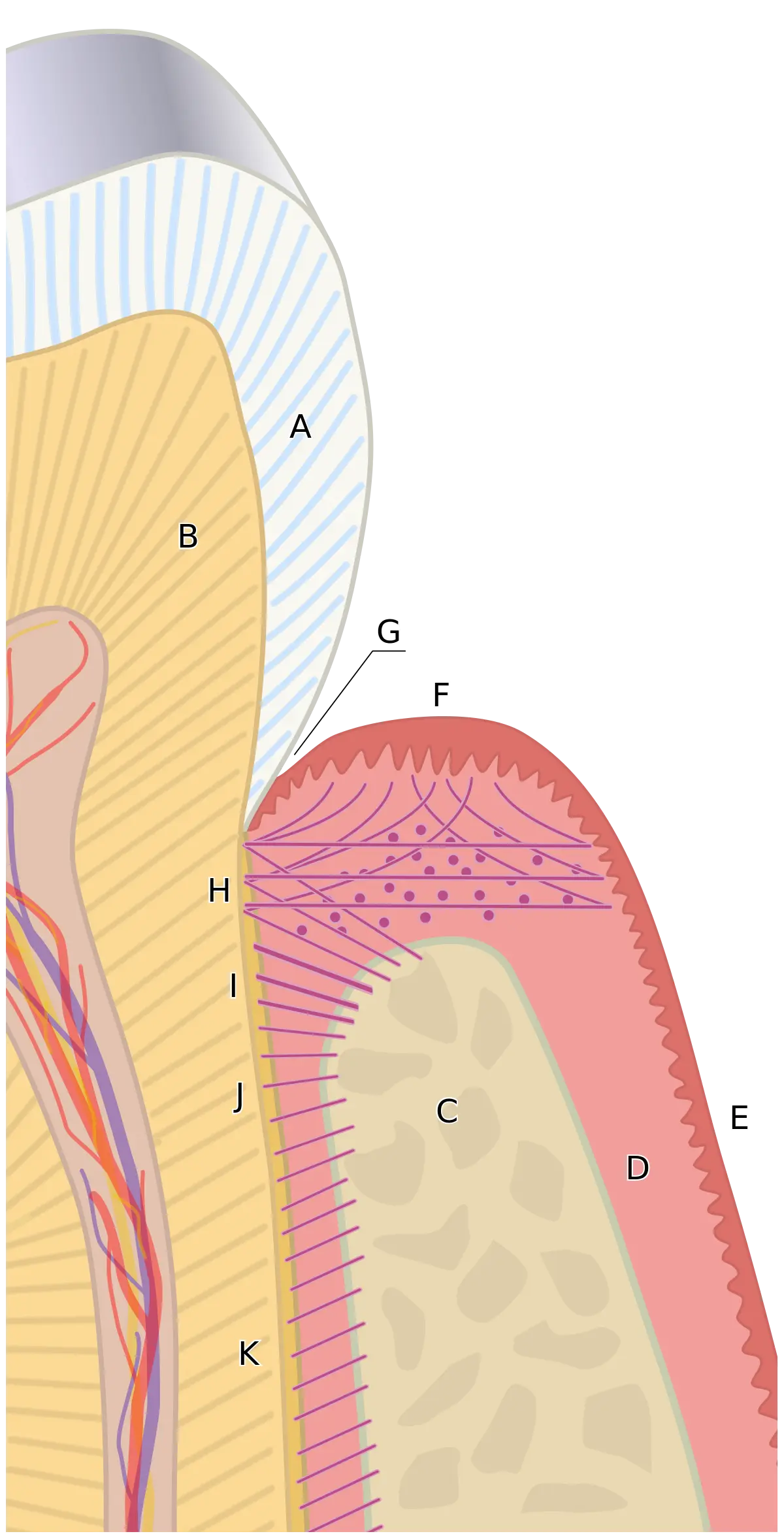 Causes of swollen gums: plaque build-up and gum inflammation