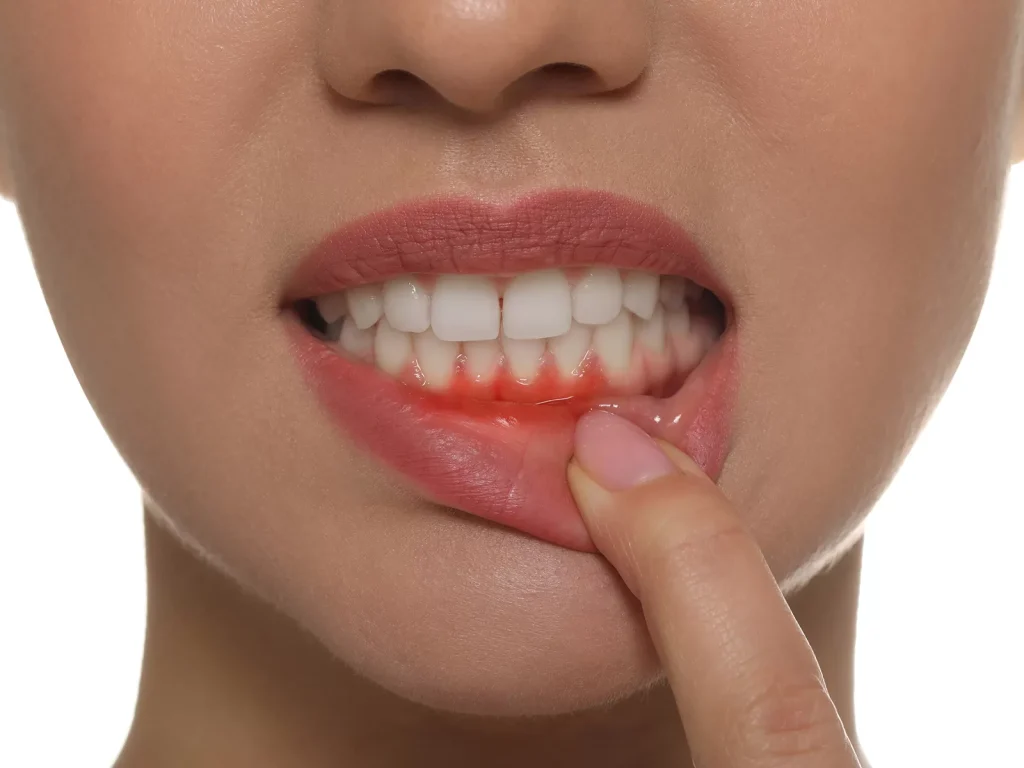 a person checking their gums because of itching