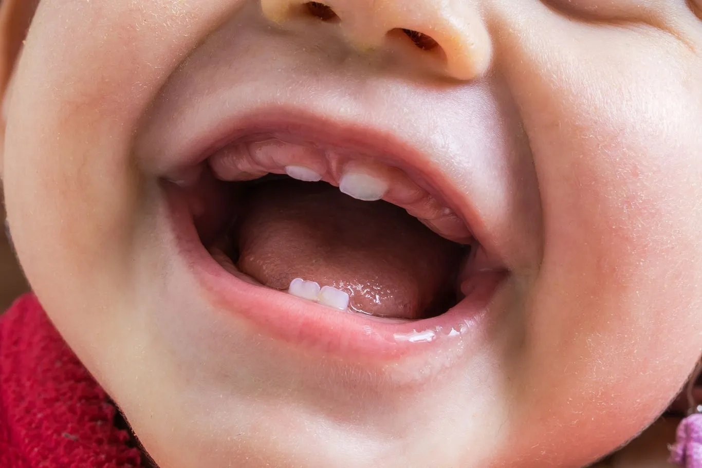 Smiling baby with the first baby teeth coming through
