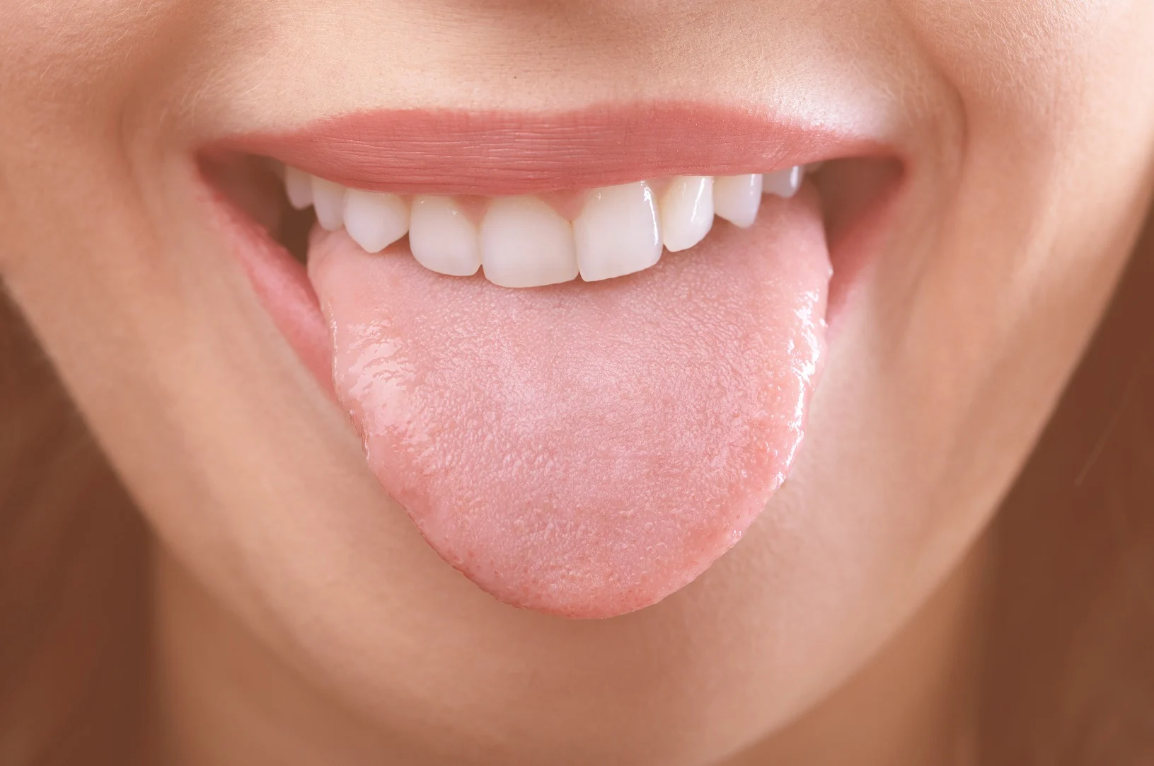 A painful tongue sore (canker sore) on the side of the tongue