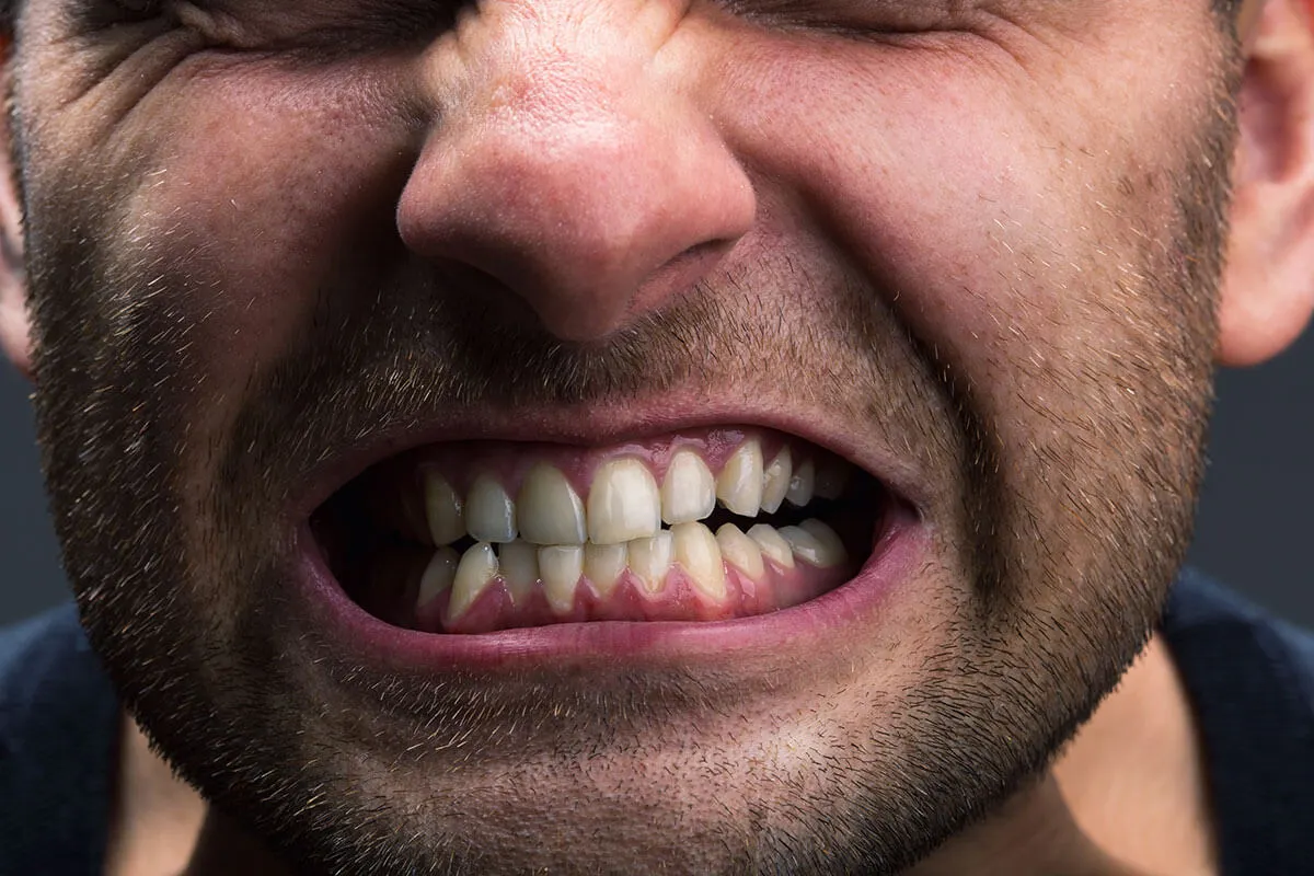 Symptoms of teeth clenching: jaw pain and worn teeth
