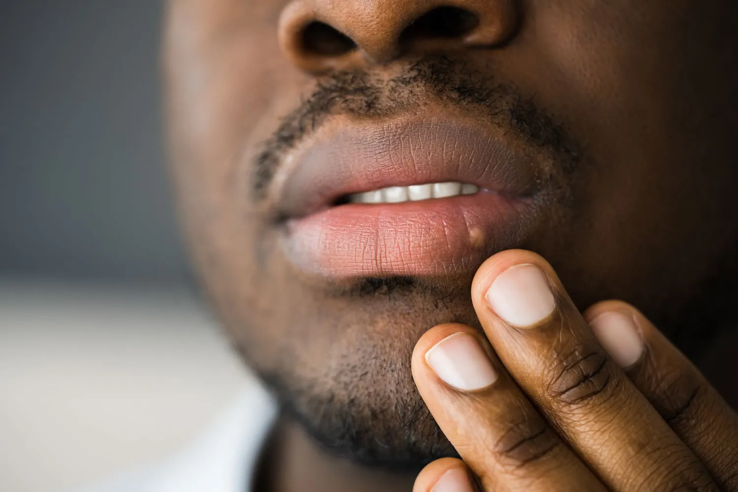 Person touching a newly formed cold sore blister on the lip with a finger