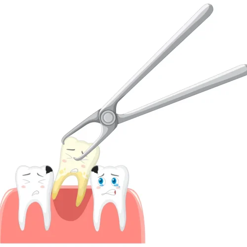 Aftercare steps to follow after a tooth extraction