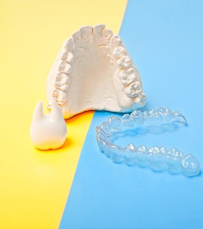 Dental impression taken for smile design