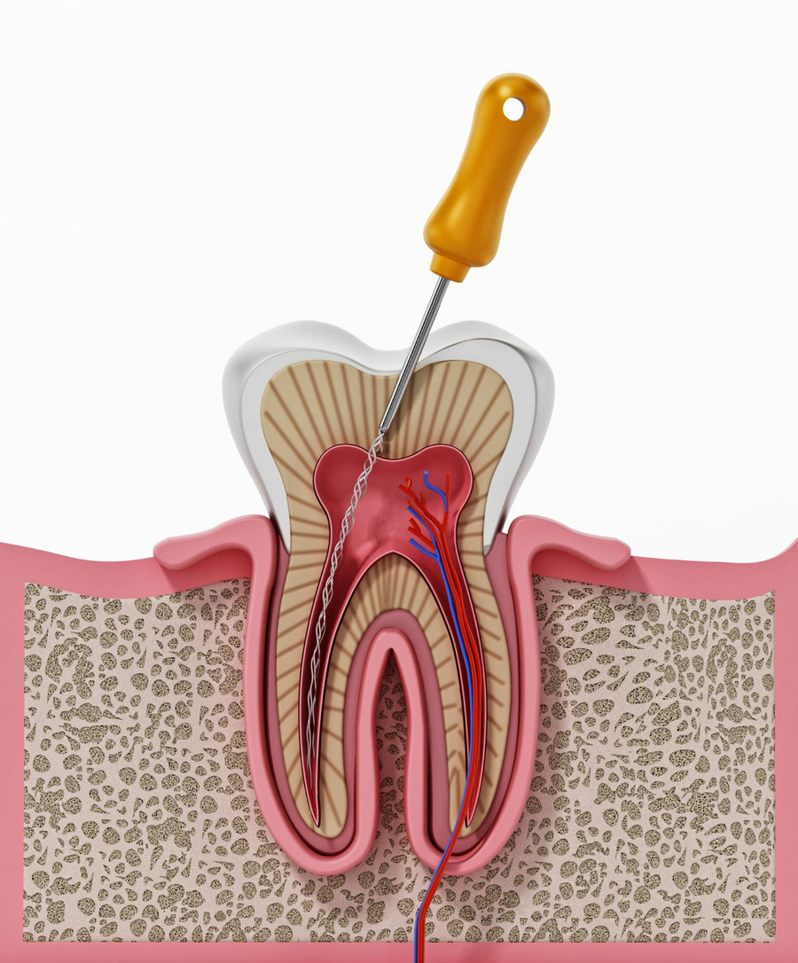 endodontics