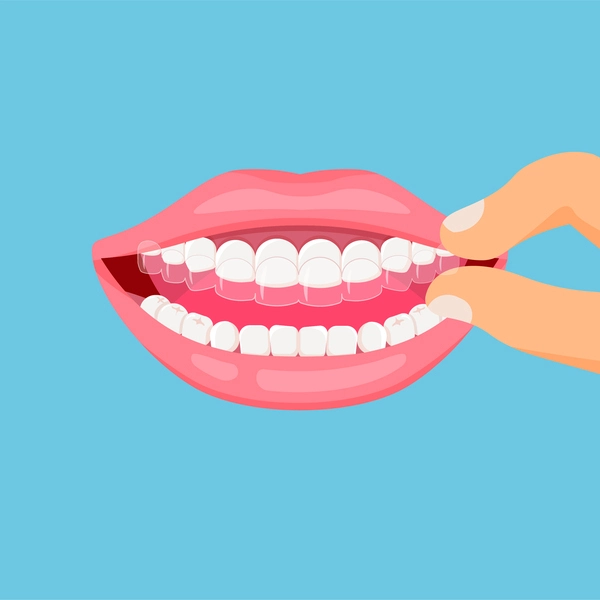 transparent-braces