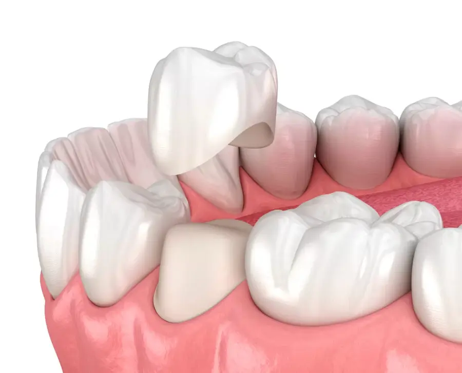restorative-dentistry what is the restorative dentistry
