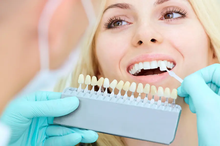 tooth-whitening-examples