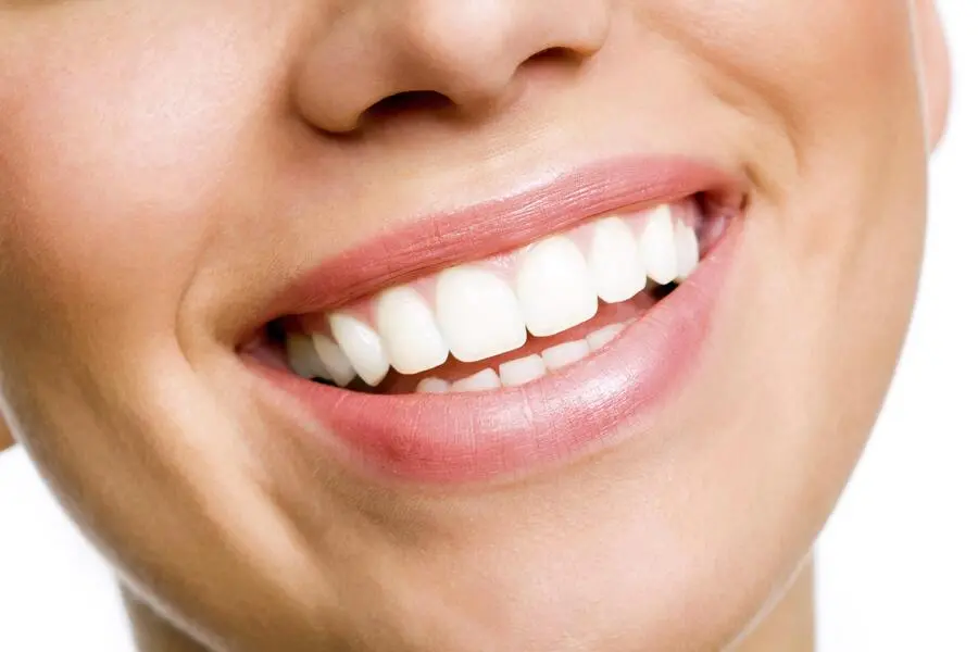 tooth-whitening-smile